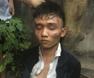 Táo tợn xông vào nhà giật túi xách, cứa cổ bà chủ tiệm tạp hóa ở Hà Nội