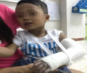 Phẫn nộ giáo viên mầm non đập bàn "vô tình" làm gãy tay bé trai 3 tuổi