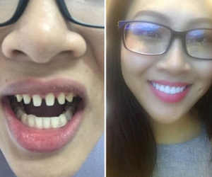 Hoa khôi Diệu Ngọc - Đại diện người đẹp Việt ở Hoa hậu Thế giới bị tố phẫu thuật thẩm mỹ