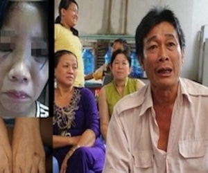 Nữ sinh run sợ kể phút bị bạn châm thuốc lá vào tay, bắt liếm chân
