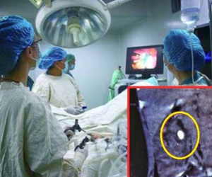 Mới 2 tuổi đã bị sỏi thận, bố mẹ chết lặng vì "thực phẩm vàng" ngày nào con cũng uống