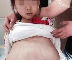 Xác nhận thông tin về bé gái đi khám thai tại Trung Quốc