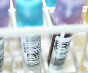 Phát triển thuốc có thể chữa khỏi HIV và AIDS