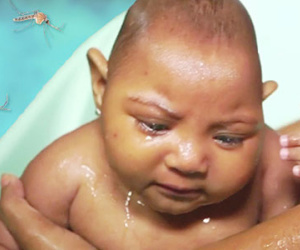 Sắp thử nghiệm thuốc điều trị Zika trên người