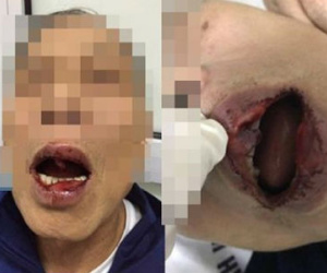 Công an vào cuộc vụ công chức đánh tiến sĩ 76 tuổi