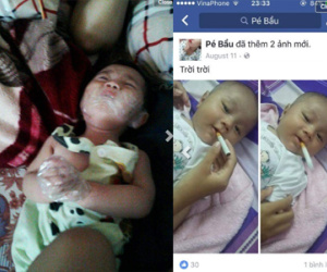 Ảnh bìa bài viết 408389