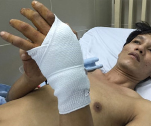 Dùng súng bắn thủng tay thanh niên trong tiệm game bắn cá