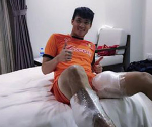 Công Vinh “khoe”... đôi chân chườm đá vì bị Malaysia chơi xấu
