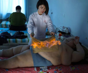Cậu bé béo phì bị "thiêu sống" để giảm cân