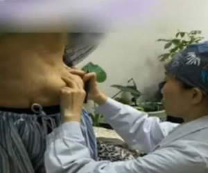 Miếng keo độn ngực trôi tuột xuống bụng sau vài năm phẫu thuật