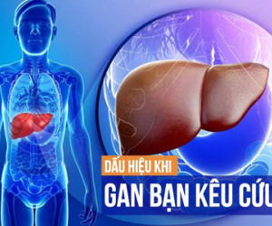 Cách tự xem gan của bạn khỏe hay yếu chỉ trong 1 phút
