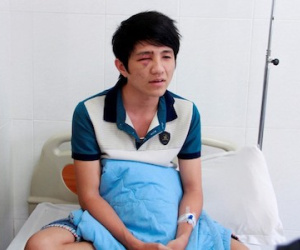 "Thanh niên không làm chủ tốc độ nên va mặt vào gậy CSGT"
