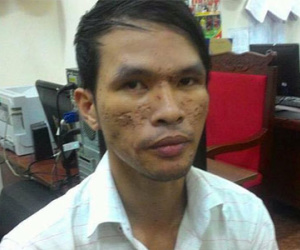Những tội danh nghi can hành hạ trẻ Campuchia có thể đối mặt