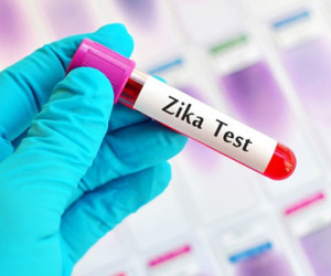 Đã tìm thấy kháng thể chống virus Zika