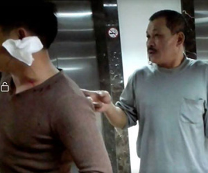 Hà Nội: Cư dân "tố" bị nhóm bảo vệ chung cư đánh rách tai chỉ vì thắc mắc chỗ đỗ ô tô