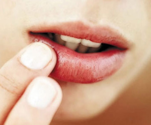 Nếu không đánh son mà thấy môi có màu như này thì bạn cần phải đi khám ngay