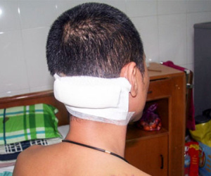 Nhóm côn đồ xông vào quán nhậu gặp ai chém nấy