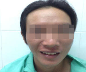 Chàng trai bỗng dưng mù trước ngày cưới vợ