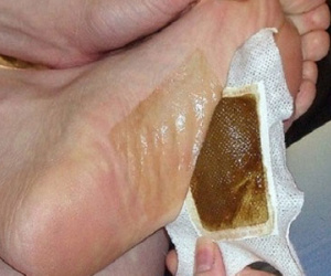 Dùng miếng dán thải độc, cẩn thận phải cắt chân vì hoại tử
