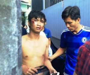 Lời khai của nam thanh niên ngáo đá, tự đổ nước mắm lên người dọa tự tử