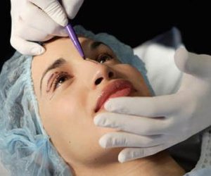 Cô gái mù mắt, liệt chân tay sau khi làm đẹp mũi