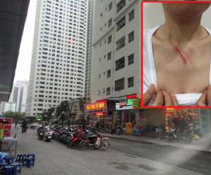 Hà Nội: Khuyên không nhổ nước bọt nơi công cộng, một phụ nữ bị đánh trong thang máy