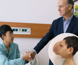 Thay đổi diệu kỳ của chàng trai Việt "không có mặt" qua 4 cuộc phẫu thuật của giáo sư Mỹ