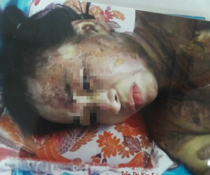 Không chịu móc cống tắc, người phụ nữ bị đồng nghiệp tạt nguyên cả nồi thịt kho đang sôi