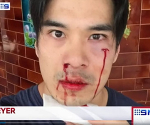 Diễn viên Thiên Nguyễn bị đánh trên đường phố Australia