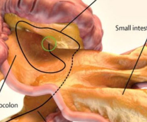 Phát hiện cơ quan mới trong cơ thể người
