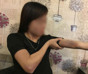 Nỗi kinh hoàng của cô gái sau khi bị bạn trai đánh dã man, thâm tím hết cả người