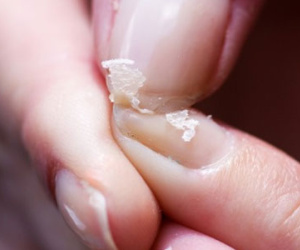 Bạn có thể phát hiện tình trạng thiếu canxi từ những câu hỏi sau