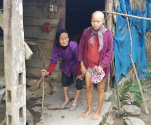 Đắng lòng mẹ già 92 tuổi lo “không có quan tài” cho con gái tâm thần