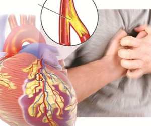 Bệnh nào giết chết nhiều người nhất trên thế giới?