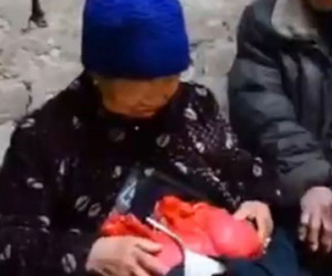 Khó tin cụ bà sống suốt 20 năm với... ruột lòi ra ngoài cơ thể
