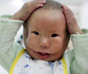 Bé trai có mặt thật như mặt nạ được nhiều người yêu mến