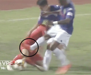 Ban trọng tài VFF: "Samson chỉ trượt lên đầu gối cầu thủ HAGL"