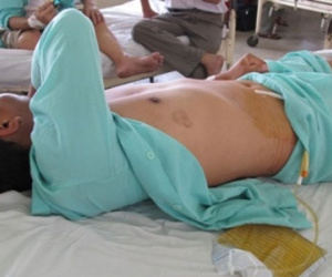 Đang nằm ngủ, bị bạn nhậu cắt đứt "của quý"