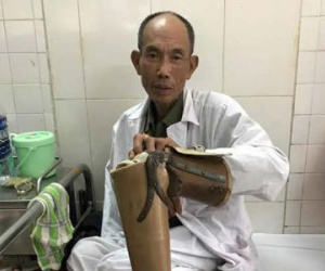 Nhóm thanh niên hành hung một thương binh sau va chạm giao thông