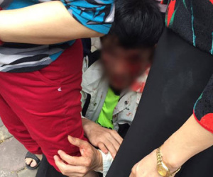 "Nếu không có người che chắn, tôi đã bị nhóm người nhầm là trộm xe SH đánh chết"