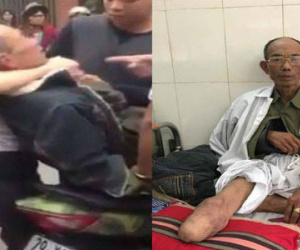 Khởi tố hai cha con hành hung thương binh do va chạm giao thông