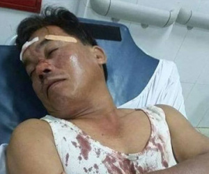 Can ngăn trai làng hỗn chiến, công an viên bị đánh gục tại chỗ