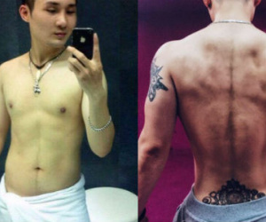 Bất chấp đau đớn, chàng trai chi 750 triệu đồng cắt bỏ xương sườn để có vòng eo bé xíu