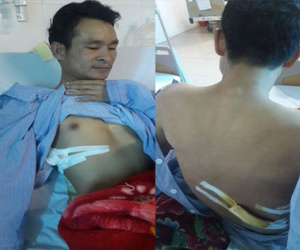 Kẻ dùng dao đâm người cứu nạn có hành vi "hết sức côn đồ"