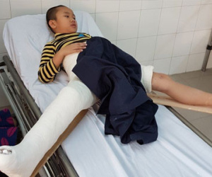Hai "sự thật" của cô hiệu trưởng về vụ xe đâm học sinh gãy chân