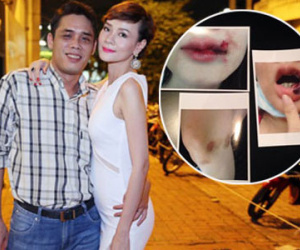 Những người đẹp từng cay đắng chia sẻ bị chồng bạo hành