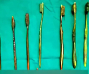 Nuốt 7 bàn chải vào bụng vì bị bố mẹ ép kết hôn