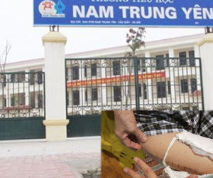 Giáo viên chủ nhiệm học sinh gãy chân tiết lộ thông tin "sốc"