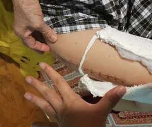 Vụ học sinh Nam Trung Yên gãy chân: 18 giáo viên phản bác ban giám hiệu