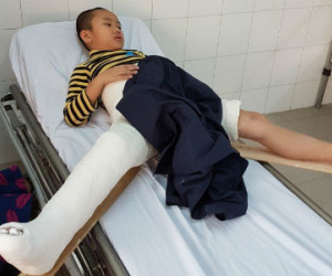 Vụ học sinh gãy chân: Công an Hà Nội đã có kết luận
